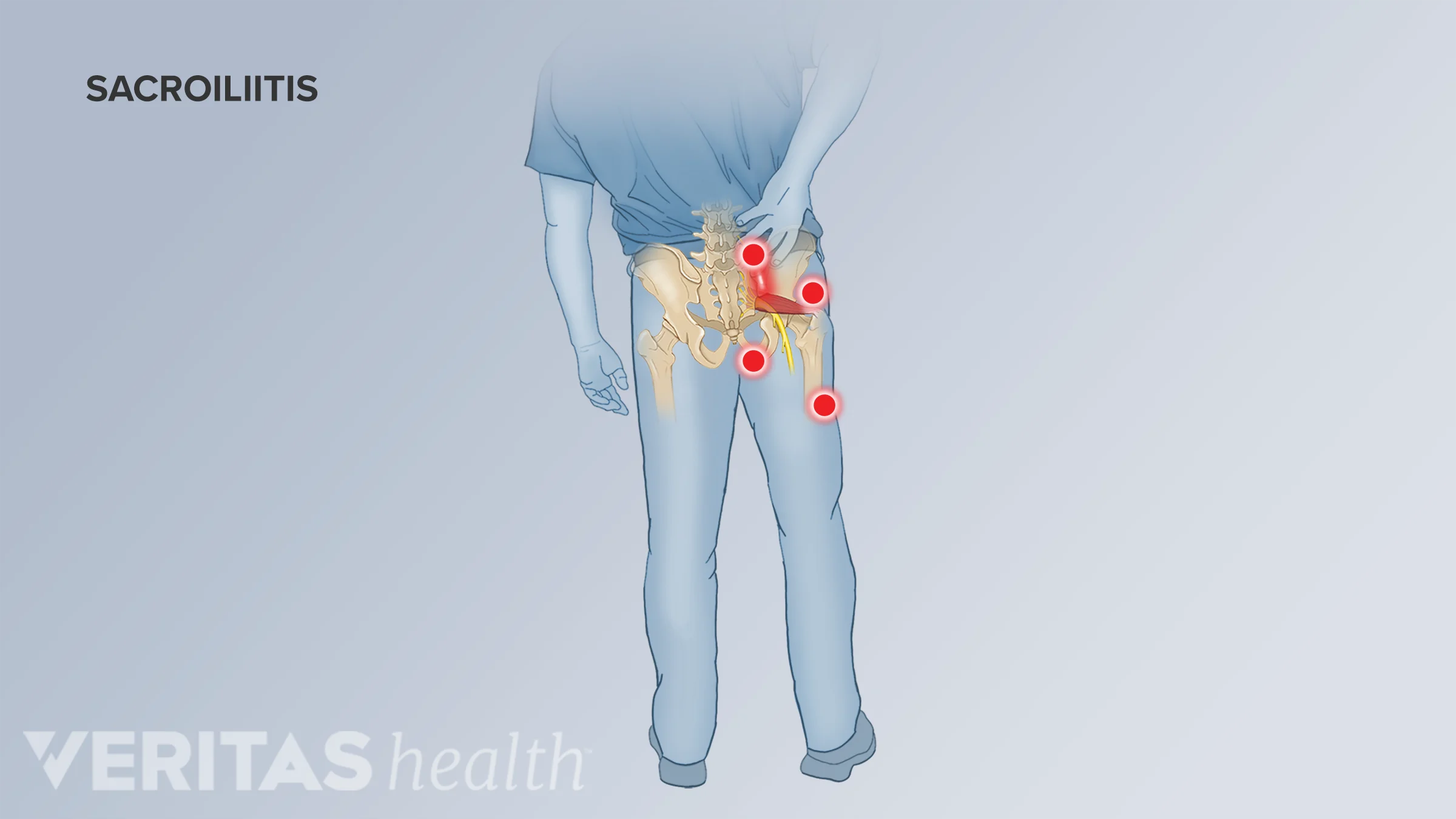 Symptoms And Diagnosis Of Sacroiliitis Spine health Symptoms And Diagnosis Of Sacroiliitis Spine health