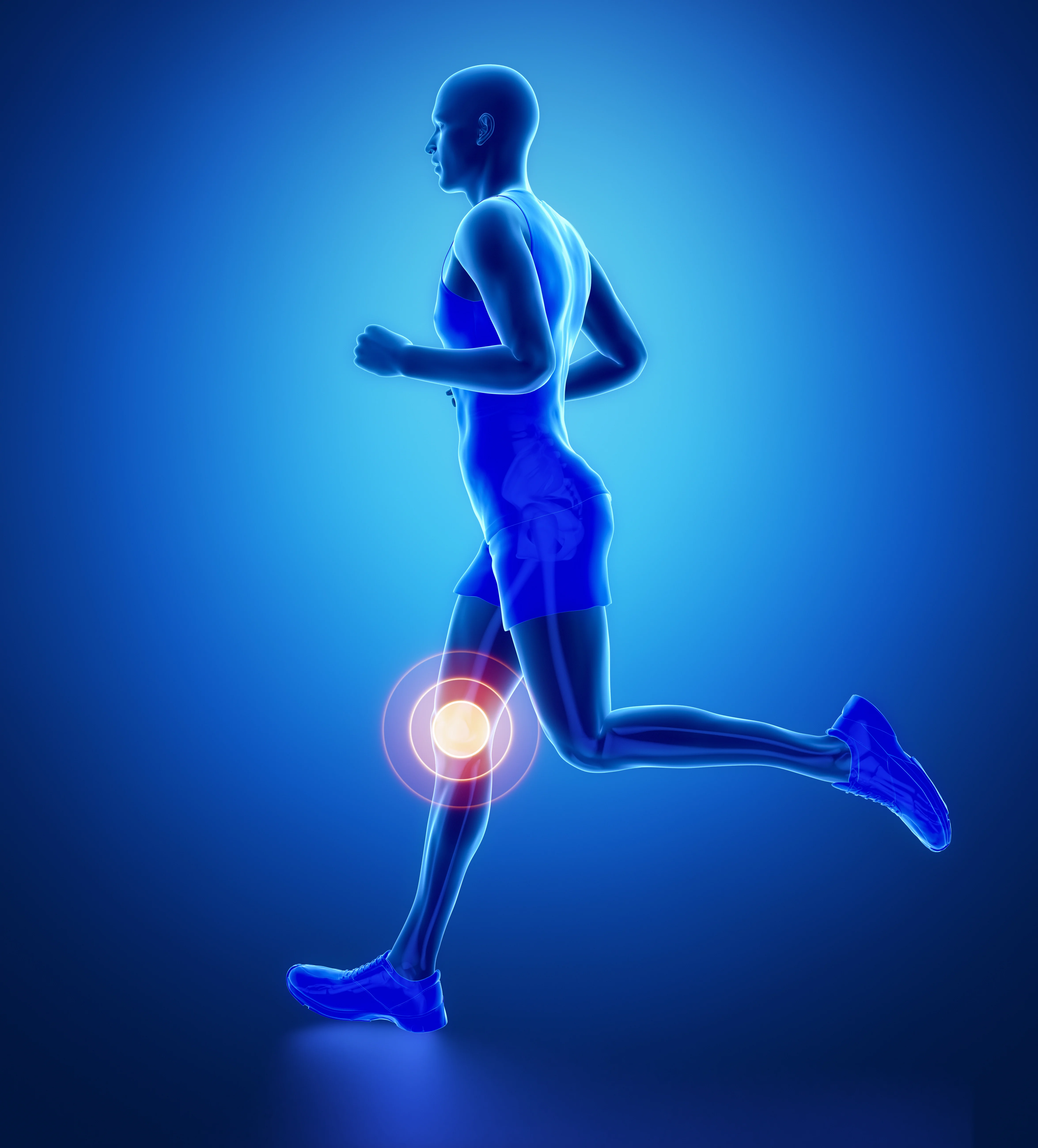 Understanding Knee Hyperextension Sports health