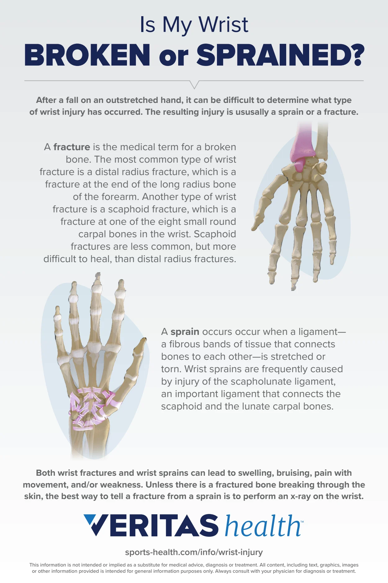 Is My Wrist Broken Or Sprained Infographic | Sports-health