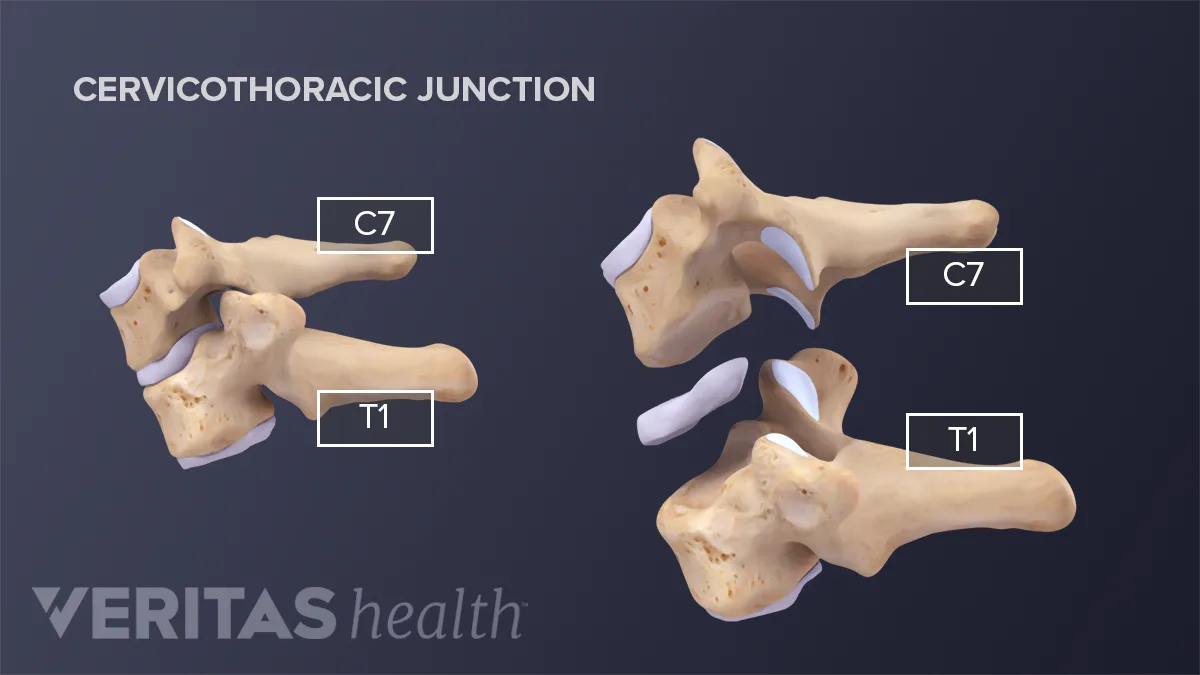 Thoracic Vertebrae and the Rib Cage