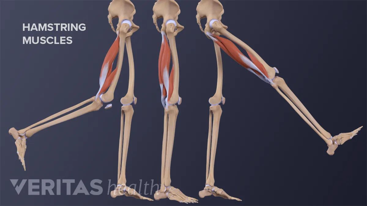 High (Proximal) Hamstring Tendinopathy Risk Factors