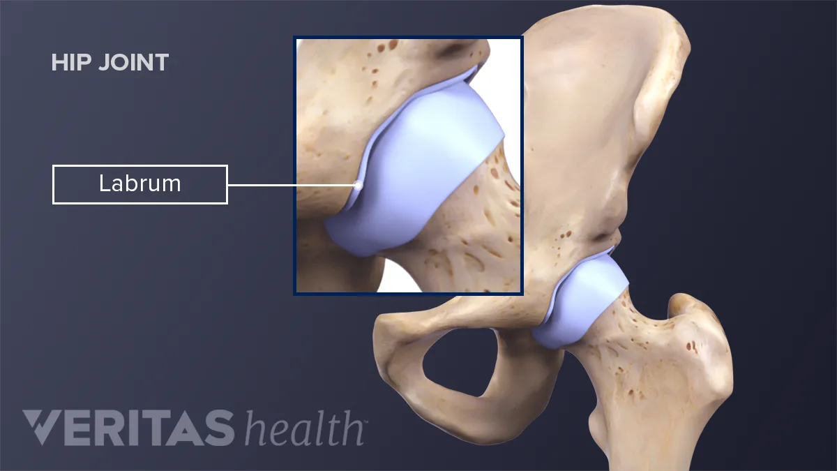 Wave Sign Labrum Hip Anatomy Labrum Hip Anatomy Physiopedia