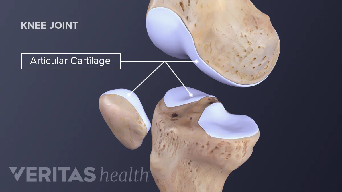 Cartilage Stem Cells Engineered To Grow Cartilage Fight Inflammation cartilage-stem-cells-engineered-to-grow-cartilage-fight-inflammation