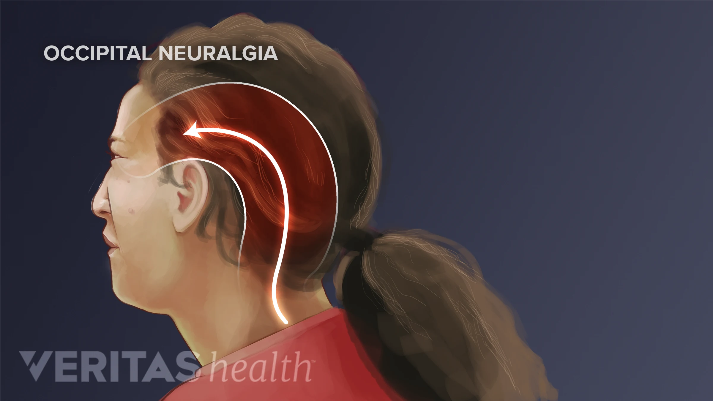Occipital Neuralgia What It Is And How To Treat It occipital-neuralgia-what-it-is-and-how-to-treat-it