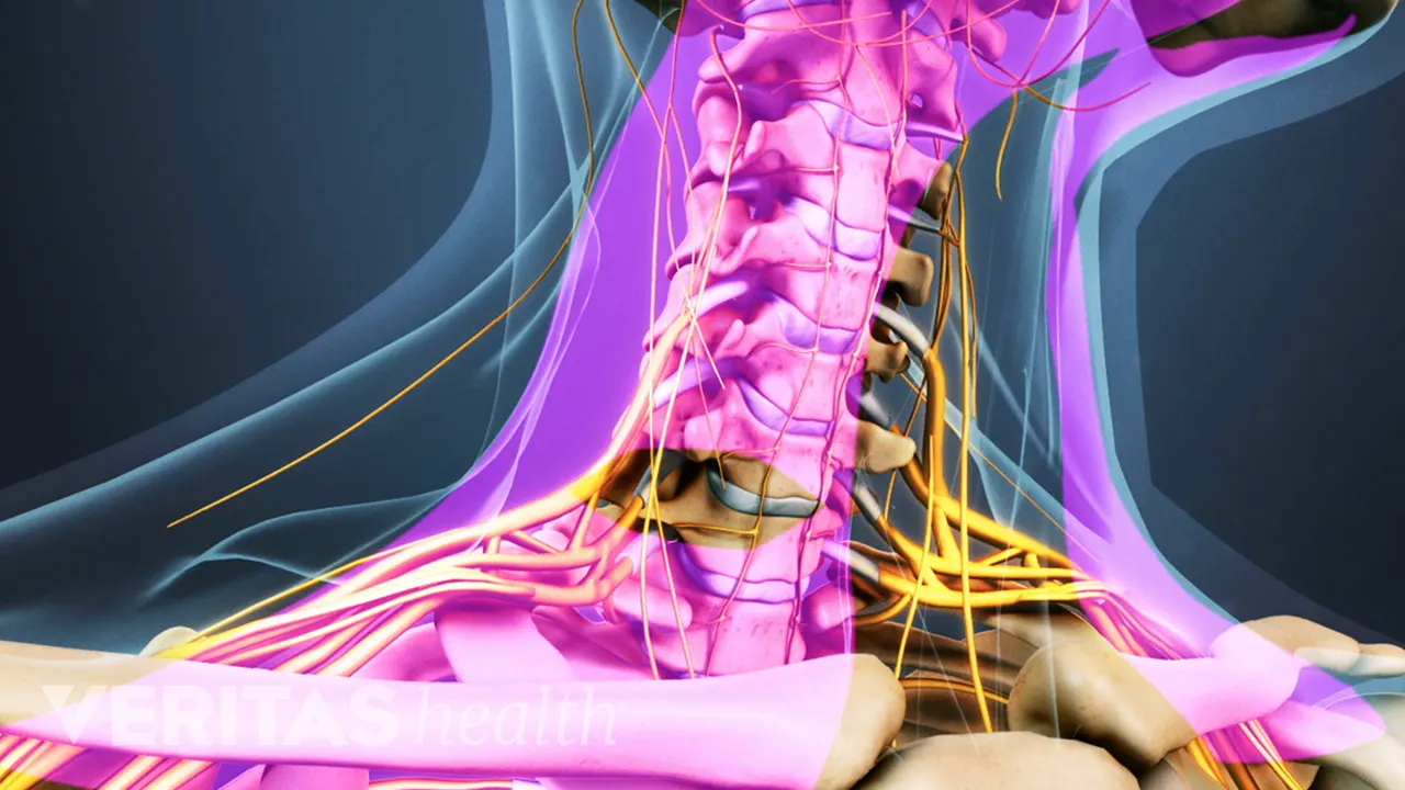 Infected Acdf Incision Hospital Care After ACDF Surgery