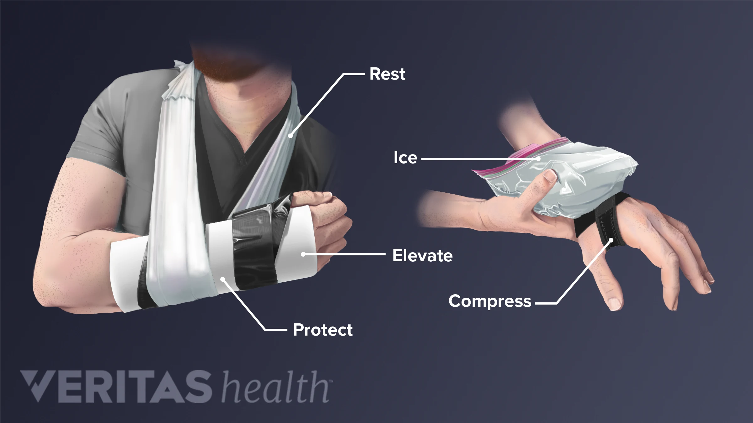A Guide To Dealing With Sprained Or Broken Wrists – UIQLO