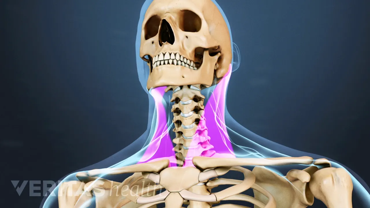 Straining Neck Angry Neck Strain: Causes and Remedies