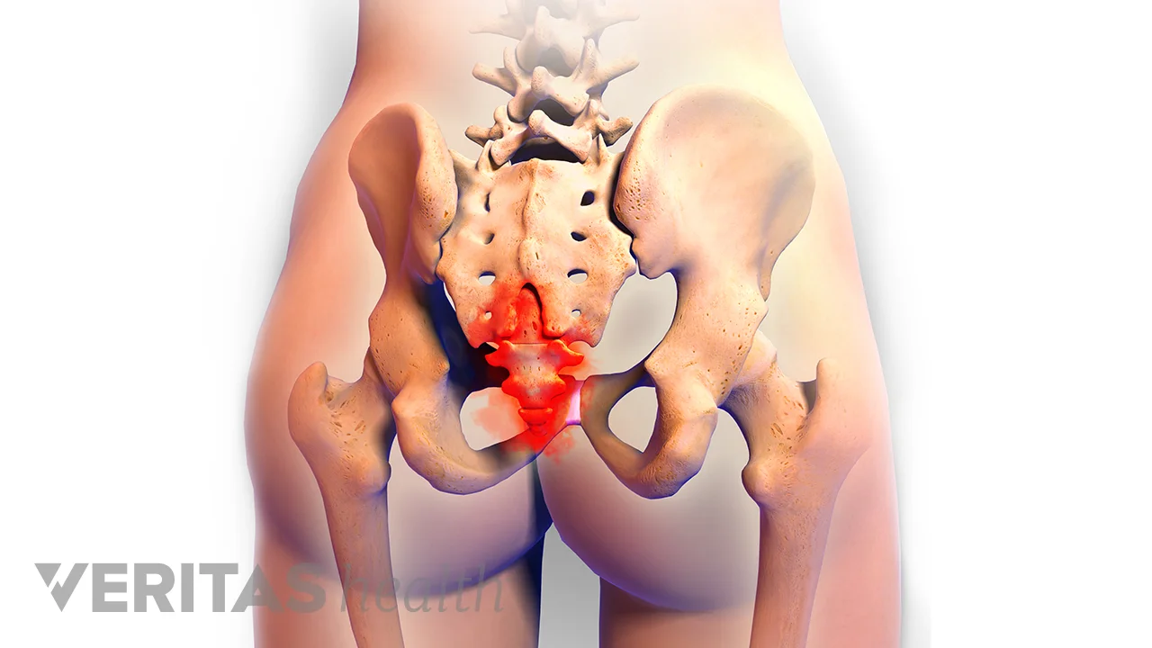 Tailbone Injuries Tailbone Pain Causes Treatment And When To See A Doctor 5184x3456