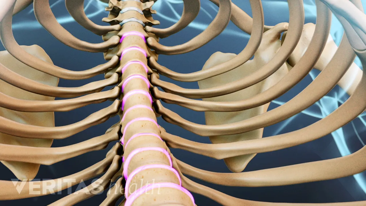 Colitis Rib Displacement Can Rib Cramps and Pain Come from the Spine?