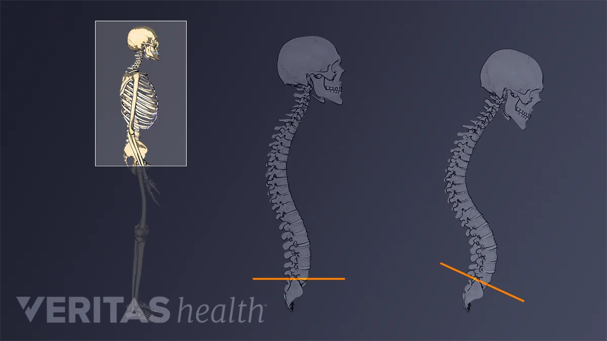Posture to Straighten Your Back
