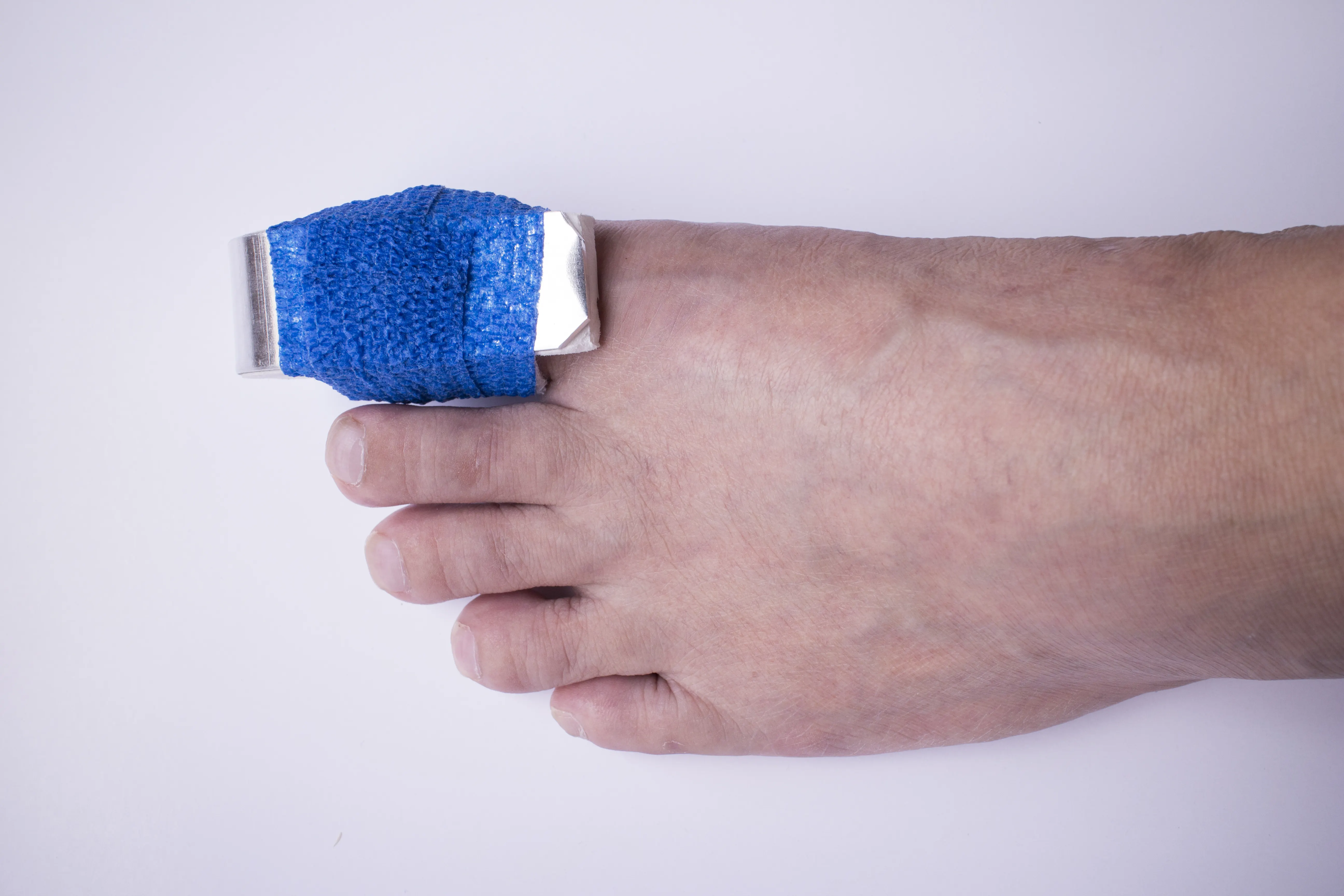 Turf Toe Treatment