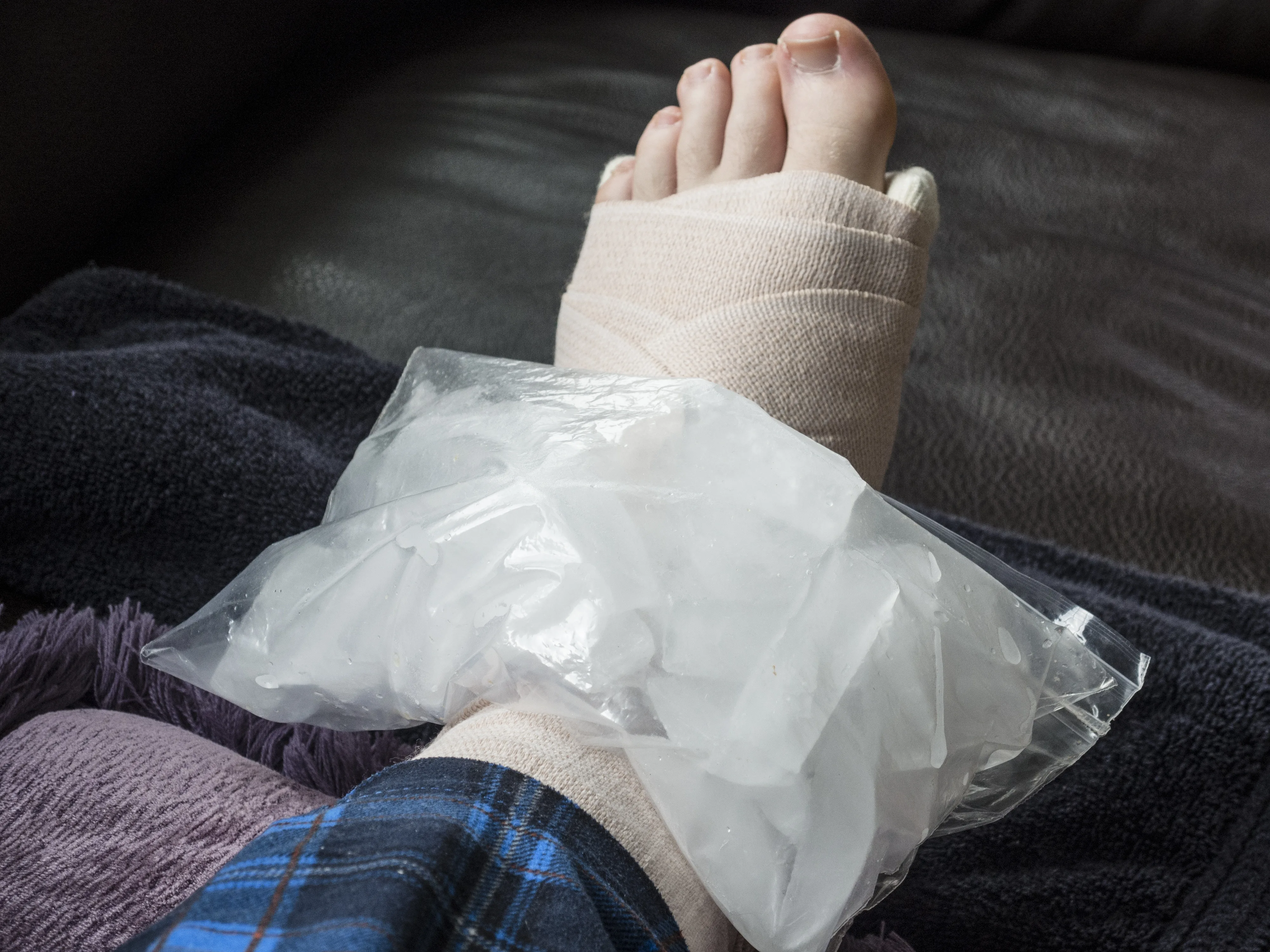Price Protocol Injury The P.R.I.C.E. Protocol Principles