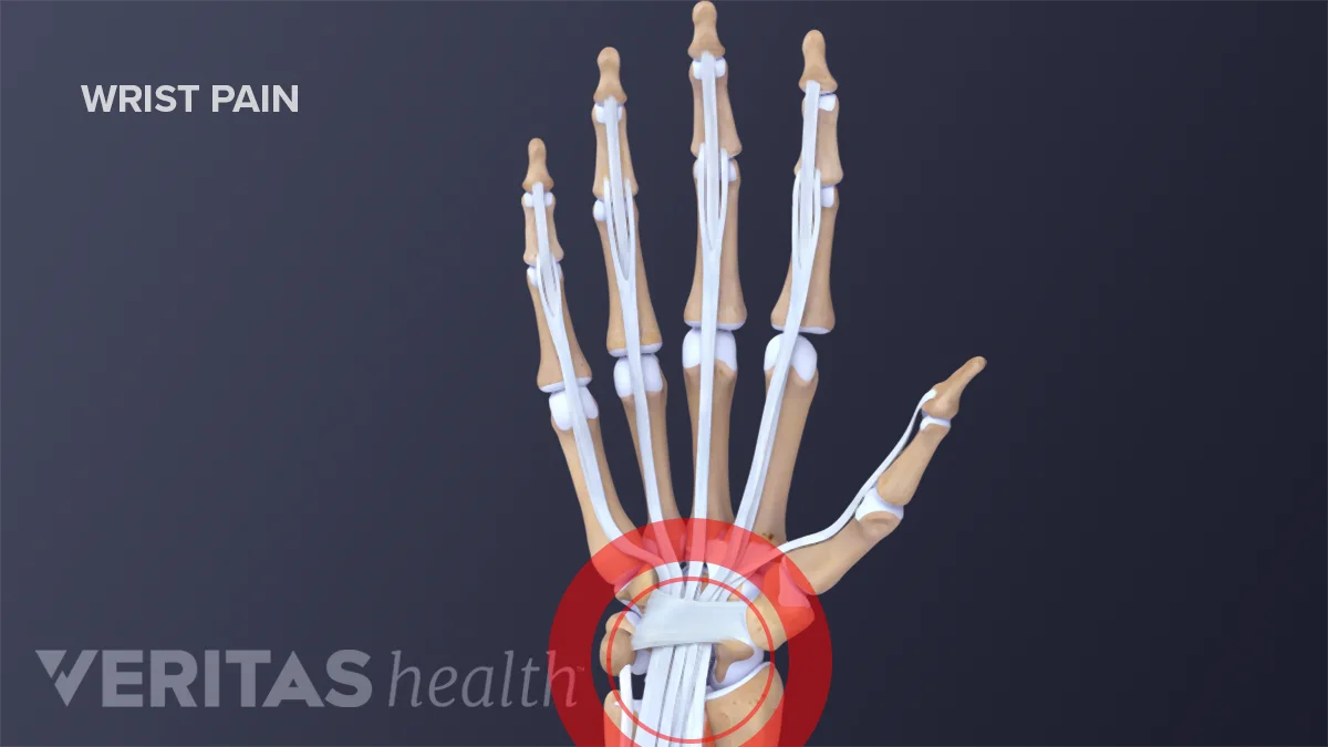 Hand and Wrist Injuries