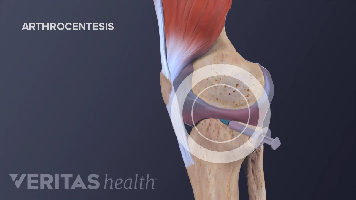 Europas größte Handelsplattform für Photovoltaik, Solarthermie & Co. intelligence overview