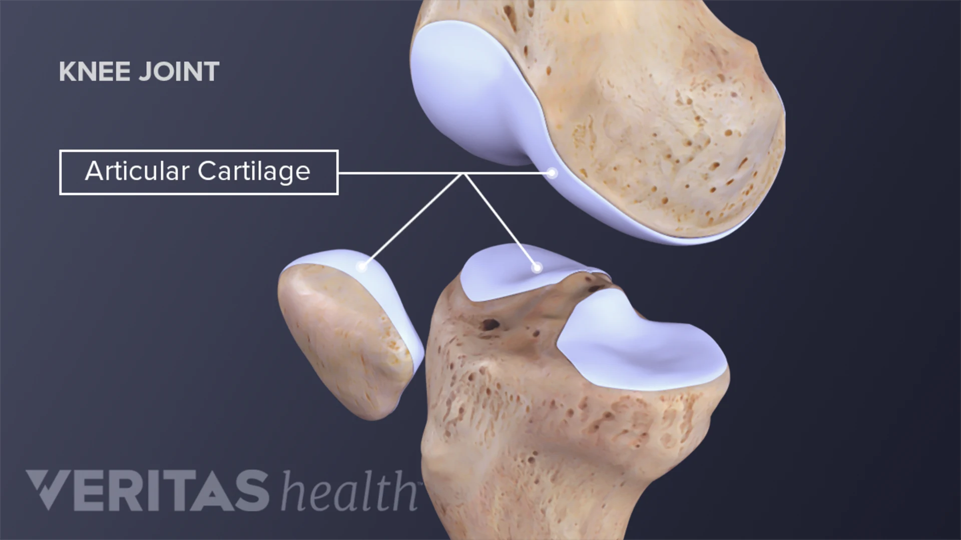 The cartilage of a human bone
