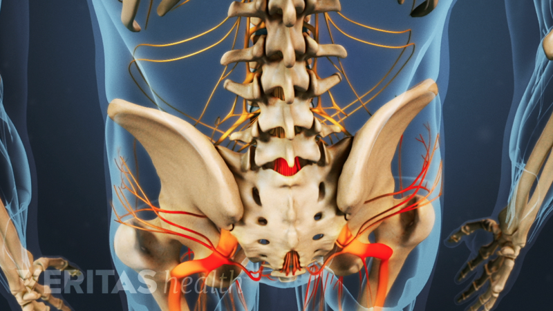 L5-S1 Isthmic Spondylolisthesis Animation | Spine-health