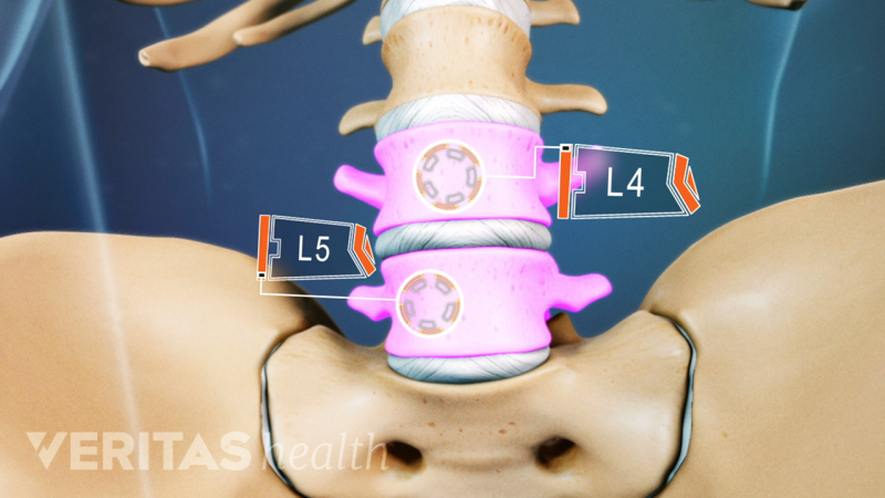 Spinal Motion Segment: L4-L5 Animation | Spine-health