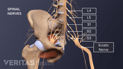 Sciatica Treatment Video