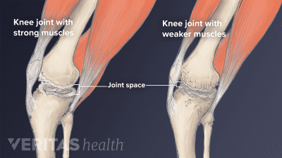 5 Knee Stretches to Reduce Arthritis Pain (Gentle for Beginners) Video