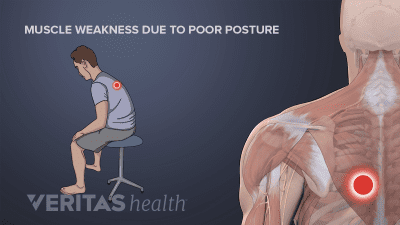 Bad posture weakens muscles