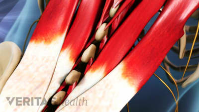 Posterior view of the muscles in the low back.