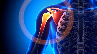 Upper body focused on the right side with pain radiating in the shoulder joint.