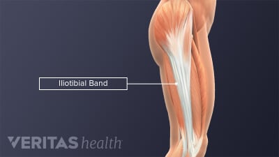 Profile view of the IT Band