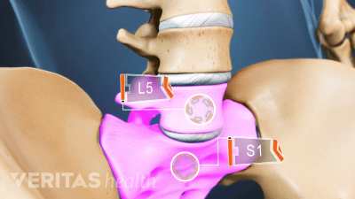 Spinal Motion Segment: L5-S1 Animation | Spine-health