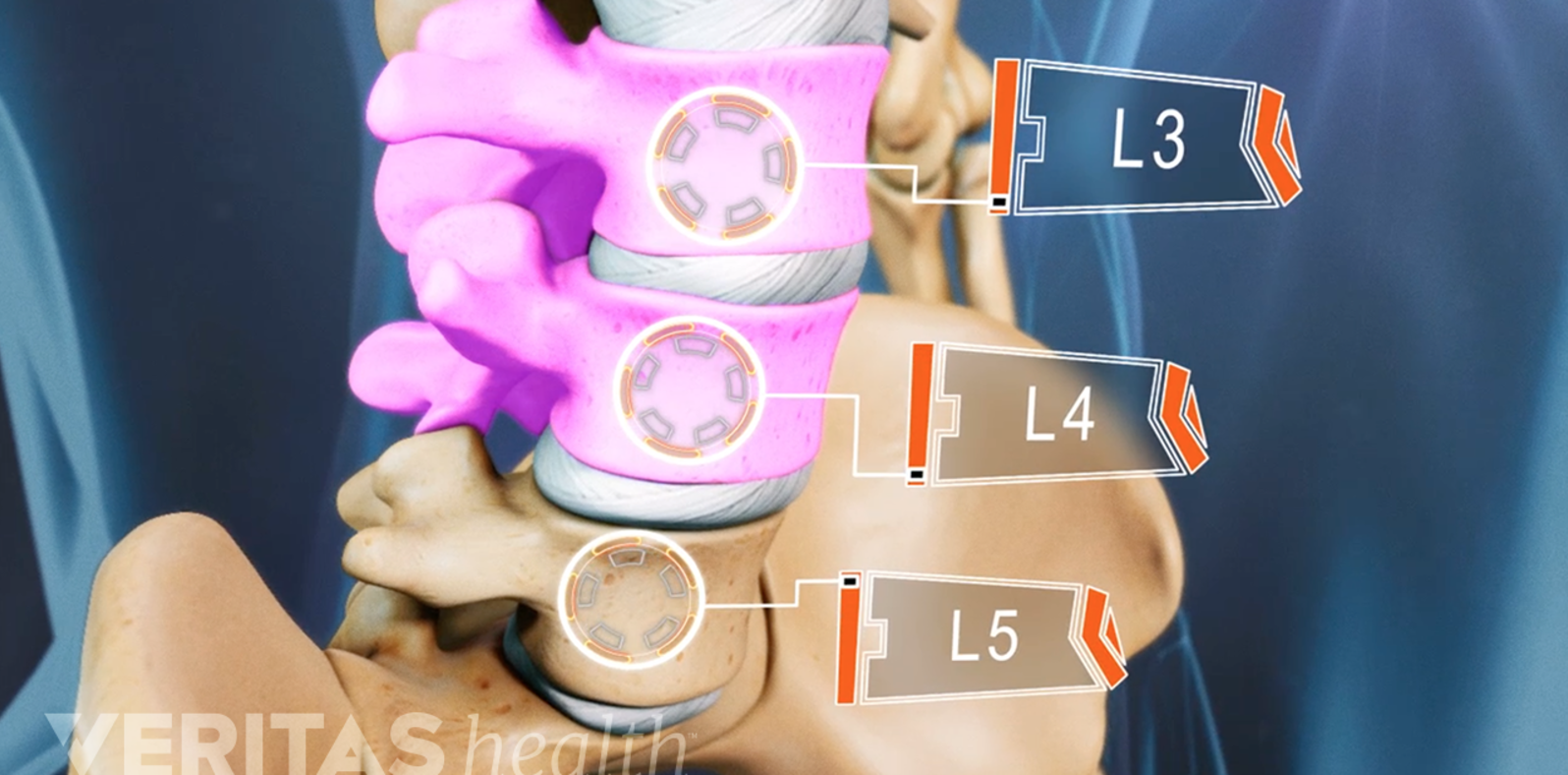 Trusted Information on Back Pain and Neck Pain | Spine-health