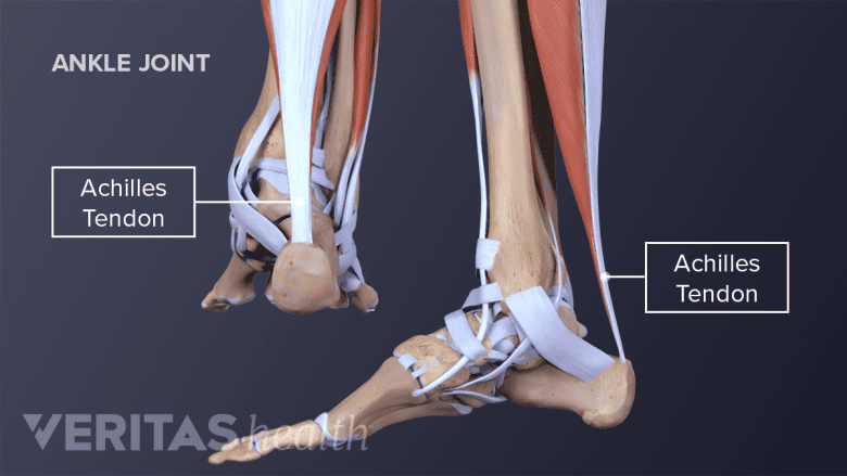 Illustration showing anatomy of ankel joint with achellis tendon.