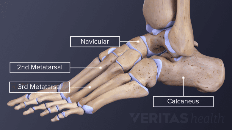 Side view of the foot labeling bones.