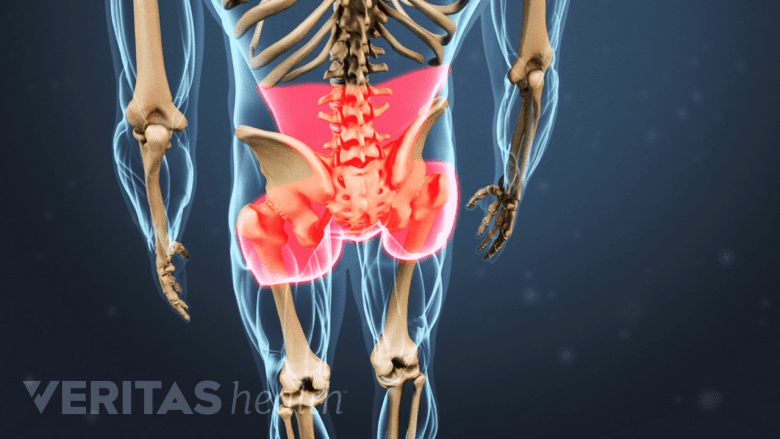 red highlight in the lower back and buttock area depicting axial back pain.