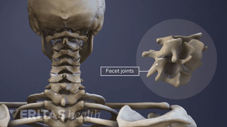 Medical illustration showing cervical facet joint.