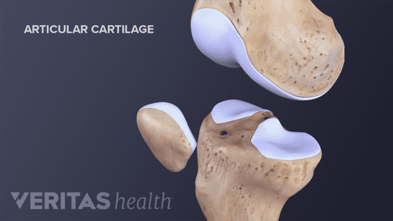 The articular cartilage in the knee.