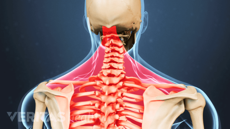 Posterior view of torso with red highlights in the neck and back.