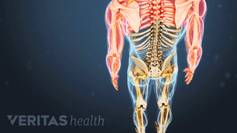 An illustration showing upper body with both arms highlighted in red.