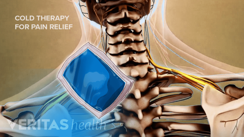 Illustration showing postrerior view of shoulder with a ice pack  icon.