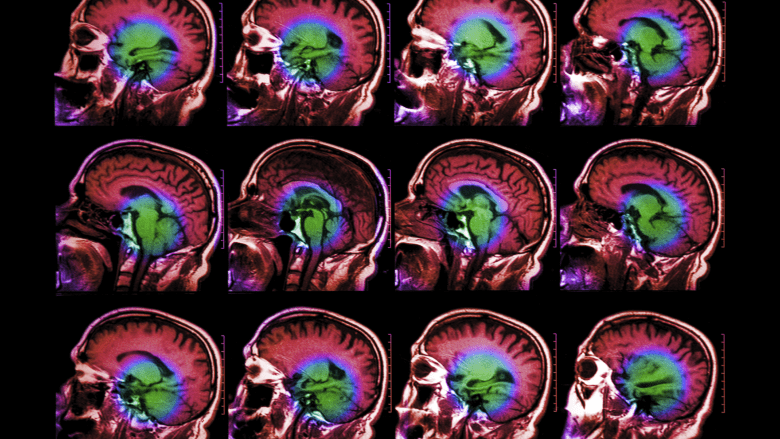 Illustration showing mri scan of the brain.
