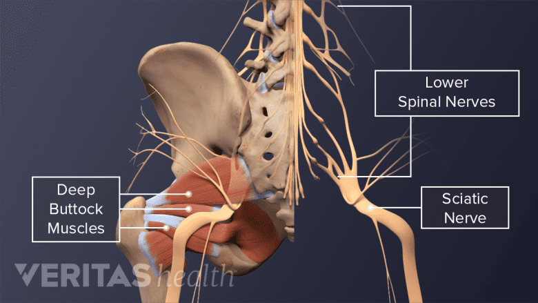 Image showing spinal nerves merging into the sciatic nerve in the lower spine and the deep buttock muscles.