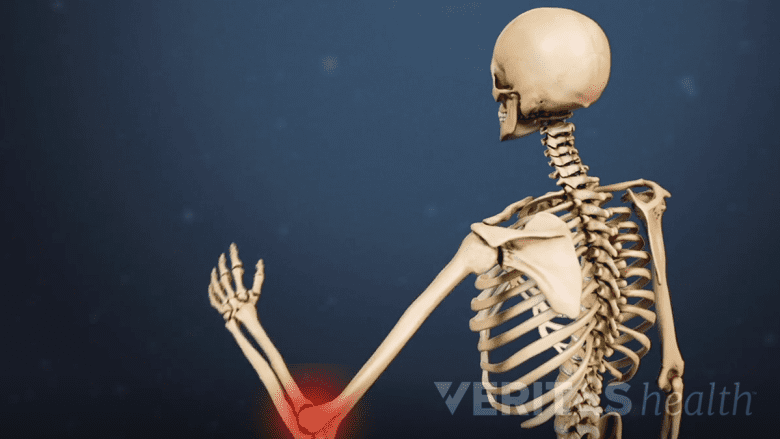 illustration showing posterior view of skeleton with red highlight on the elbow.