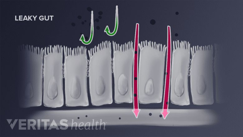 Leaky gut diagram