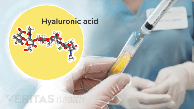 Illustration of hyaluronic acid injection and molecular composition