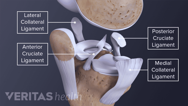 The 4 collateral ligaments in the knee: ACL, PCL, MCL, LCL.