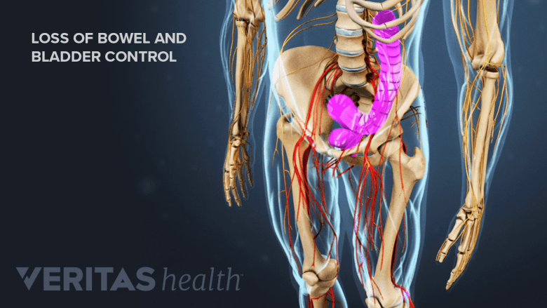 Illustration showing pelvis with bowel and bladder highlighted in pink.
