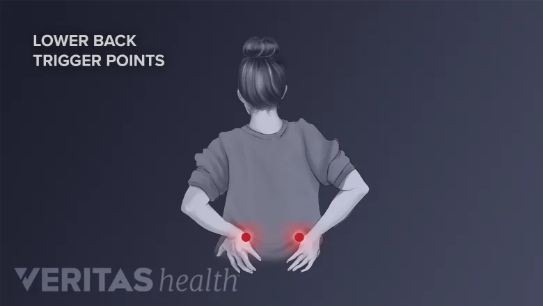 Pain in the low back area.
