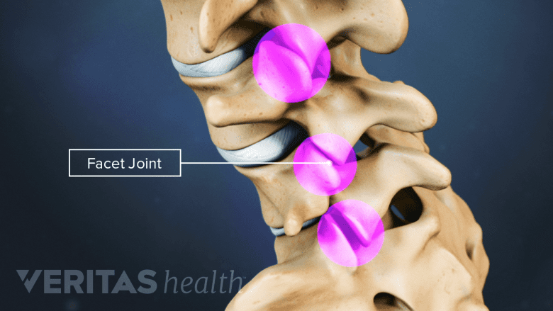 An illustration showing facet joint in the lumbar spinal vertebra.