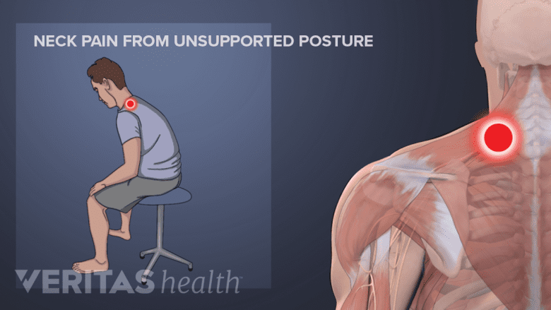 Illustration showing a man sitting in a poor posture and a model with a red trigger point in the back