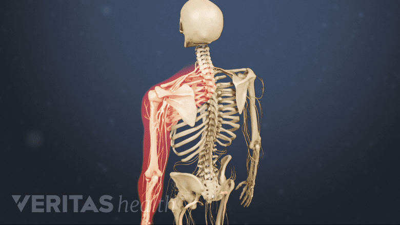 An illustration showing upper limb highlighted in red.