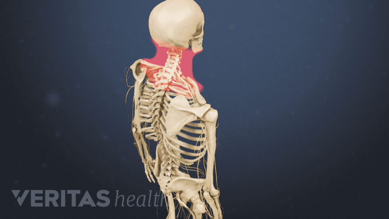 Illustration showing area in the neck highlighted in red.