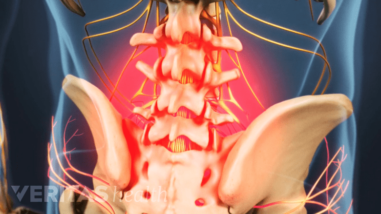 Back pain confined to the lower back area.